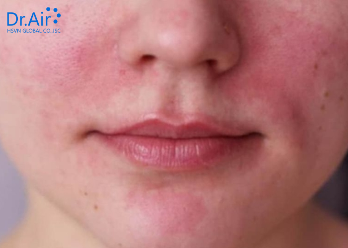 Những vấn đề thường gặp khi độ ẩm cao