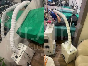 Ứng dụng của máy hút khói Dr.Air KL101